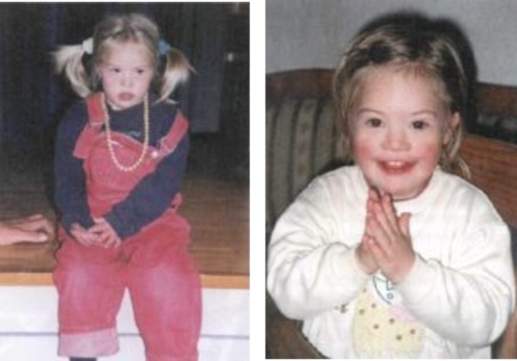 Anna 4 before and after