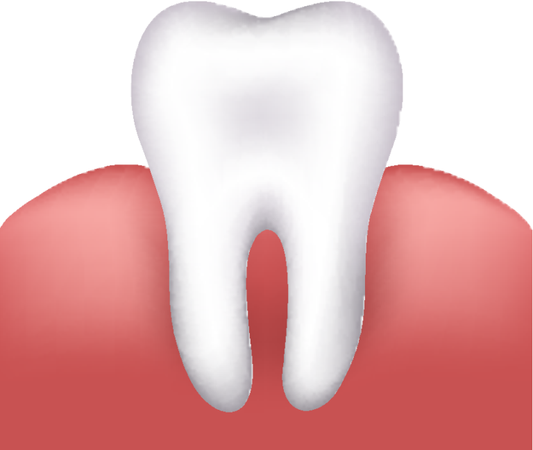 tooth w gums teeth dental intact- depositphotos
